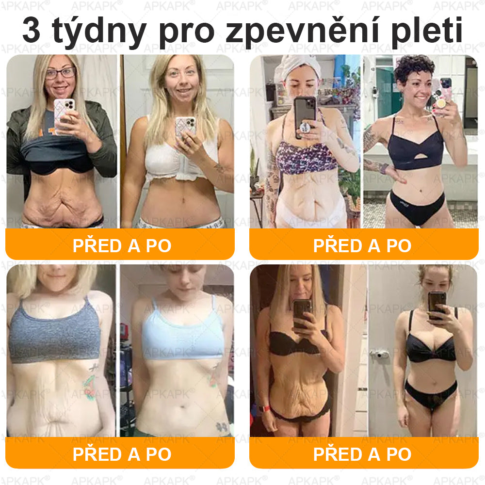 👩‍⚕️ Dermatologicky testováno 🐝 APKAPK® Včelí jed krém pro obnovu pleti – péče o vrásky, jizvy, skvrny a nedokonalosti