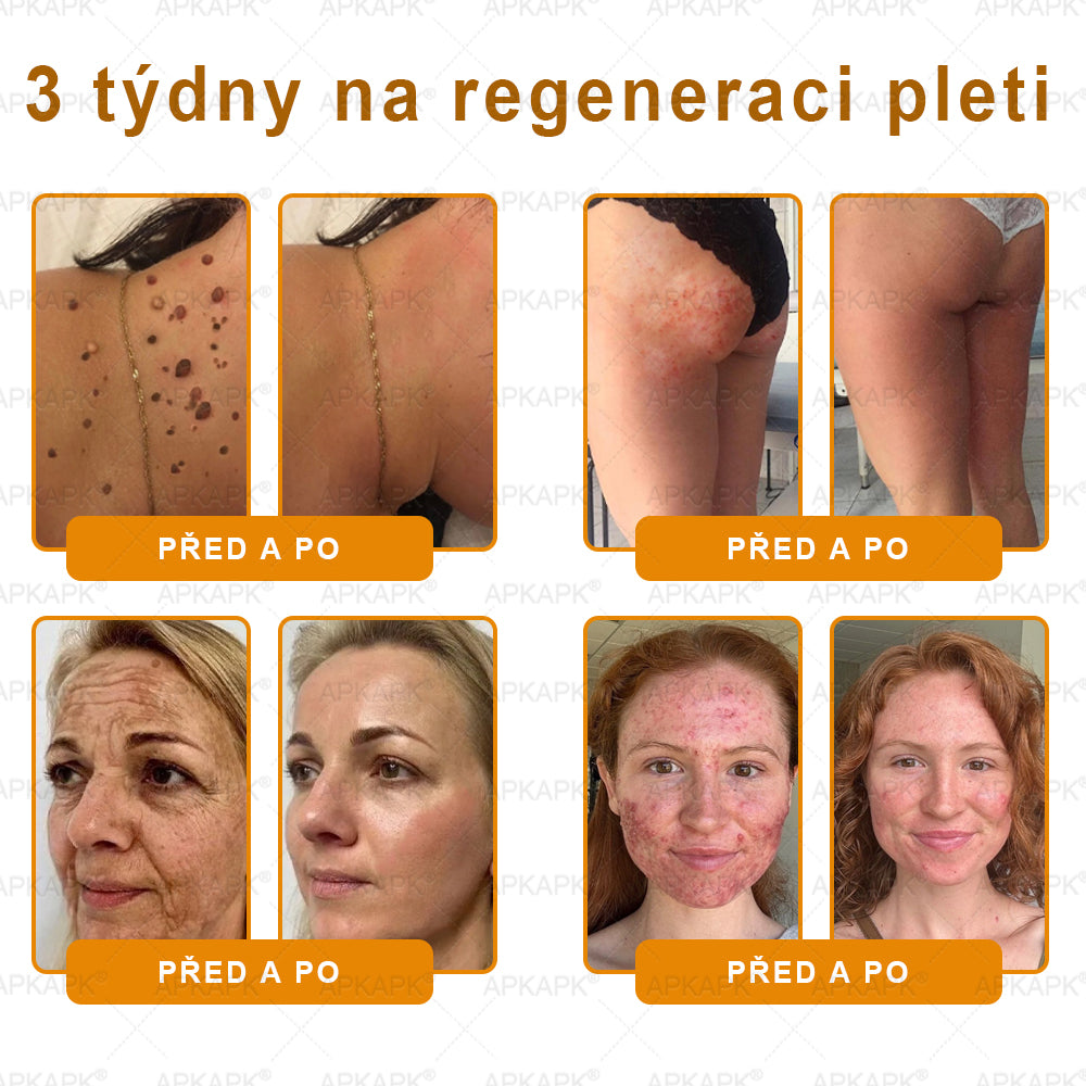 👩‍⚕️ Dermatologicky testováno 🐝 APKAPK® Včelí jed krém pro obnovu pleti – péče o vrásky, jizvy, skvrny a nedokonalosti