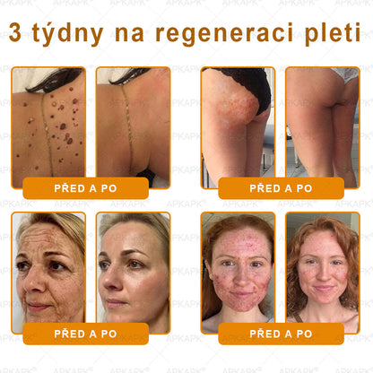 👩‍⚕️ Dermatologicky testováno 🐝 APKAPK® Včelí jed krém pro obnovu pleti – péče o vrásky, jizvy, skvrny a nedokonalosti