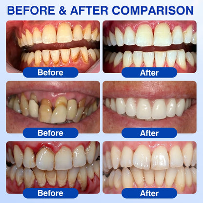 cz🏆🦷✨Evolvion GumRevive parodontální reparalogický gel Evolvion® GumRevive