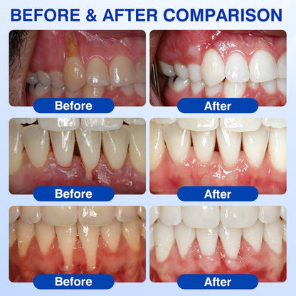 cz🏆🦷✨Evolvion GumRevive parodontální reparalogický gel Evolvion® GumRevive