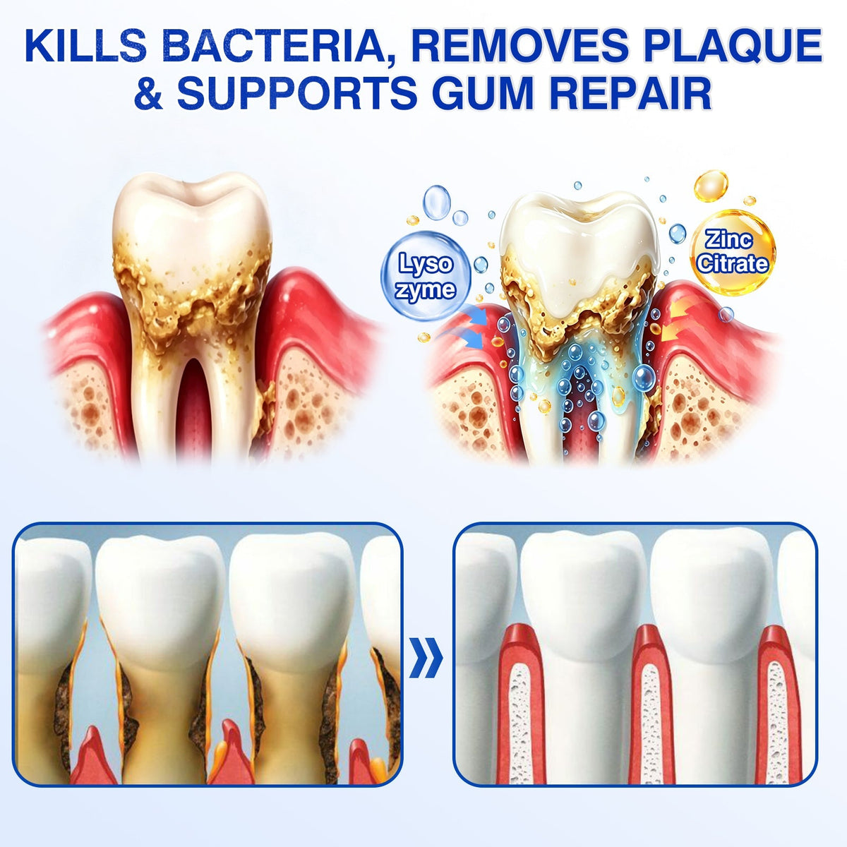 cz🏆🦷✨Evolvion GumRevive parodontální reparalogický gel Evolvion® GumRevive