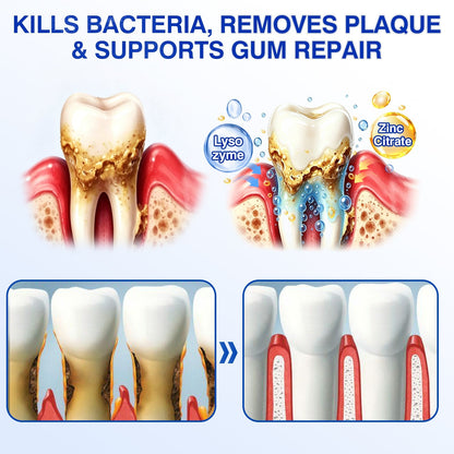 cz🏆🦷✨Evolvion GumRevive parodontální reparalogický gel Evolvion® GumRevive