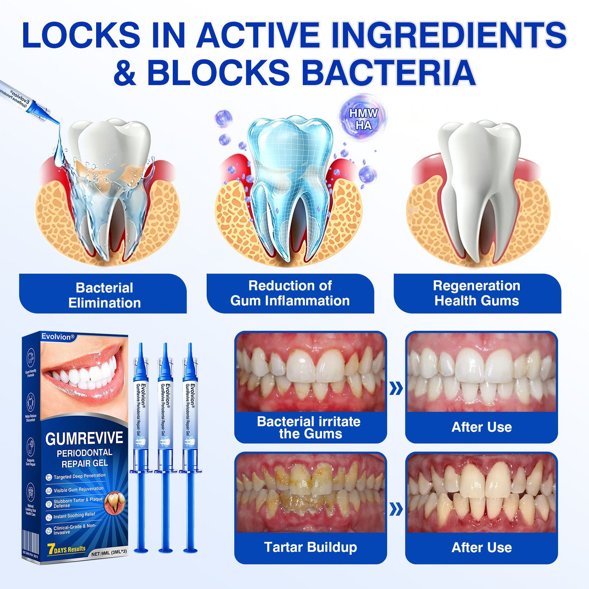 cz🏆🦷✨Evolvion GumRevive parodontální reparalogický gel Evolvion® GumRevive