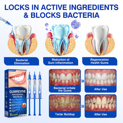 cz🏆🦷✨Evolvion GumRevive parodontální reparalogický gel Evolvion® GumRevive