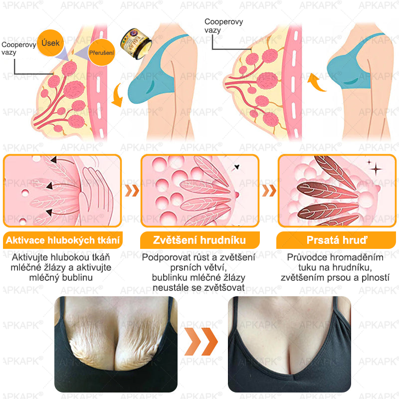 👩‍⚕️ Dermatologicky testováno 🐝 APKAPK® Včelí jed krém pro obnovu pleti – péče o vrásky, jizvy, skvrny a nedokonalosti