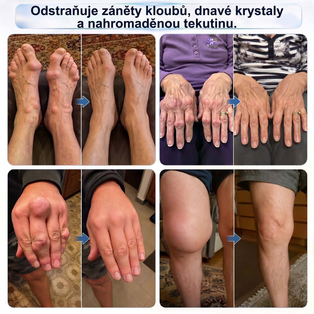 💥💥DR.HONOR® Menthol · Arnika · Ďáblův dráp 10 v 1 Roll-on pro péči o klouby a svaly | Na dnu, ztuhlost kloubů, otoky a bolesti svalů | Rychle se vstřebává, nezanechává mastný pocit