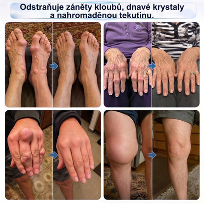 💥💥DR.HONOR® Menthol · Arnika · Ďáblův dráp 10 v 1 Roll-on pro péči o klouby a svaly | Na dnu, ztuhlost kloubů, otoky a bolesti svalů | Rychle se vstřebává, nezanechává mastný pocit