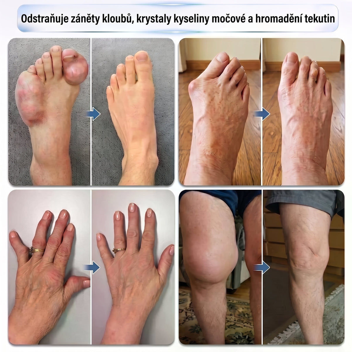 💥💥DR.HONOR® Menthol · Arnika · Ďáblův dráp 10 v 1 Roll-on pro péči o klouby a svaly | Na dnu, ztuhlost kloubů, otoky a bolesti svalů | Rychle se vstřebává, nezanechává mastný pocit