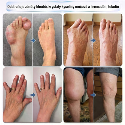 💥💥DR.HONOR® Menthol · Arnika · Ďáblův dráp 10 v 1 Roll-on pro péči o klouby a svaly | Na dnu, ztuhlost kloubů, otoky a bolesti svalů | Rychle se vstřebává, nezanechává mastný pocit