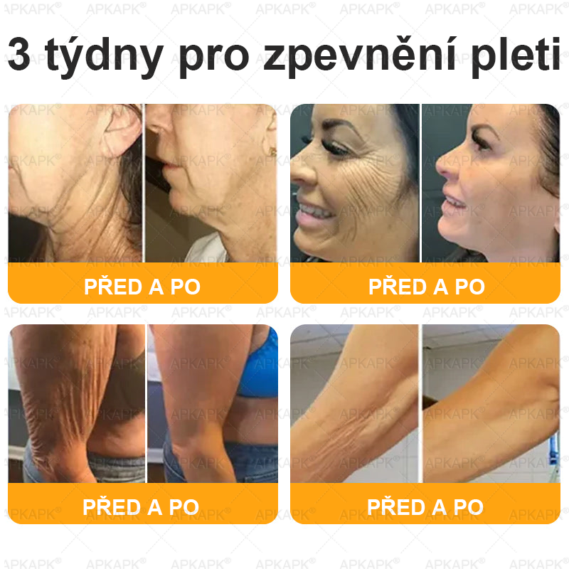 👩‍⚕️ Dermatologicky testováno 🐝 APKAPK® Včelí jed krém pro obnovu pleti – péče o vrásky, jizvy, skvrny a nedokonalosti