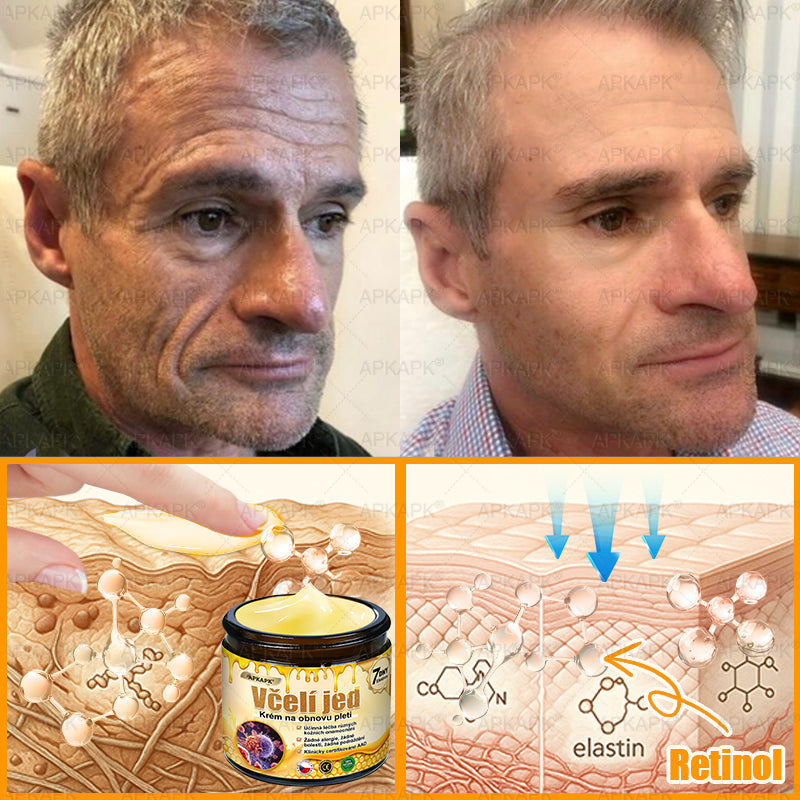 👩‍⚕️ Dermatologicky testováno 🐝 APKAPK® Včelí jed krém pro obnovu pleti – péče o vrásky, jizvy, skvrny a nedokonalosti