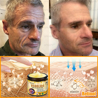 👩‍⚕️ Dermatologicky testováno 🐝 APKAPK® Včelí jed krém pro obnovu pleti – péče o vrásky, jizvy, skvrny a nedokonalosti