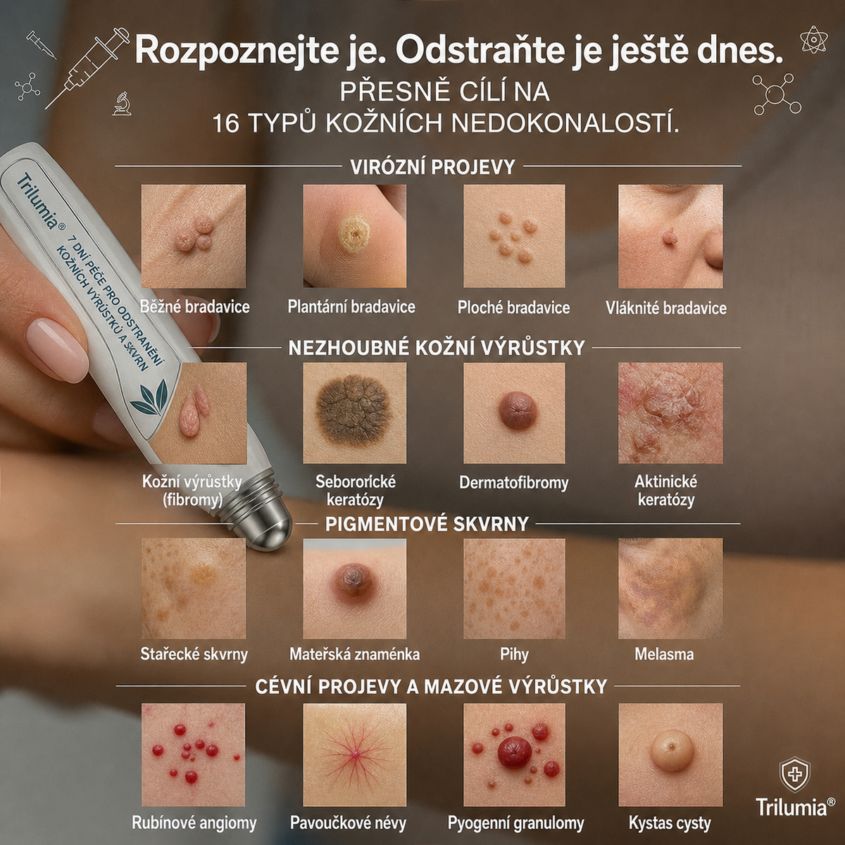 Oficiální obchod značky👨‍🔬Trilumia® 7denní odstraňovač kožních výrůstků a pigmentových skvrn🍔 (Bez bolesti, bez jizev – Roll-on)-7232