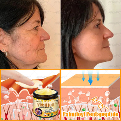 👩‍⚕️ Dermatologicky testováno 🐝 APKAPK® Včelí jed krém pro obnovu pleti – péče o vrásky, jizvy, skvrny a nedokonalosti