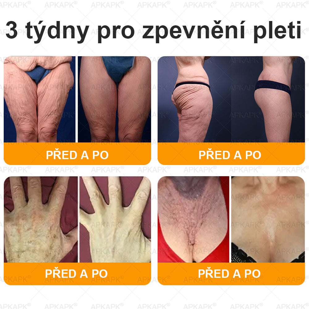 👩‍⚕️ Dermatologicky testováno 🐝 APKAPK® Včelí jed krém pro obnovu pleti – péče o vrásky, jizvy, skvrny a nedokonalosti